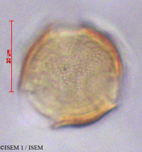 ISEM 1/Cinchona_lucumifolia_29128/Cinchona_lucumifolia_29128_0001(copy)_thumb.jpg